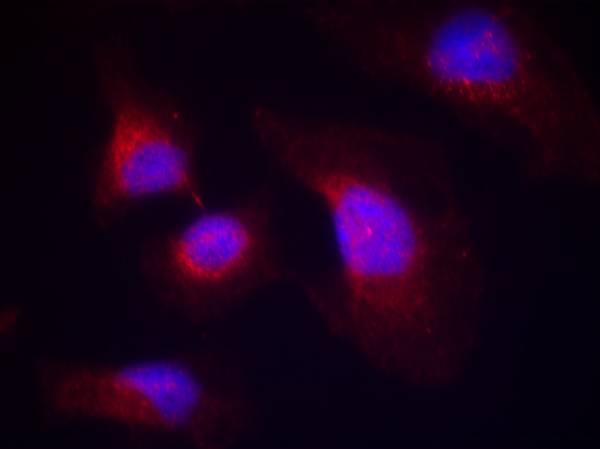 syk(phospho-Tyr323) Antibody