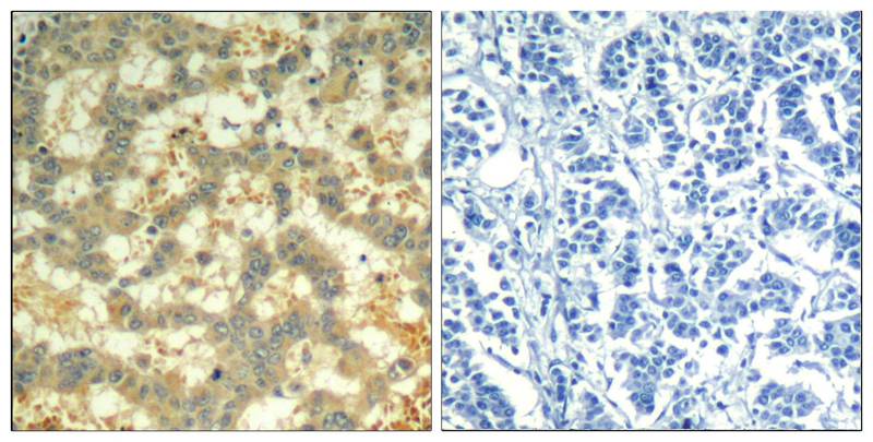 syk(phospho-Tyr323) Antibody