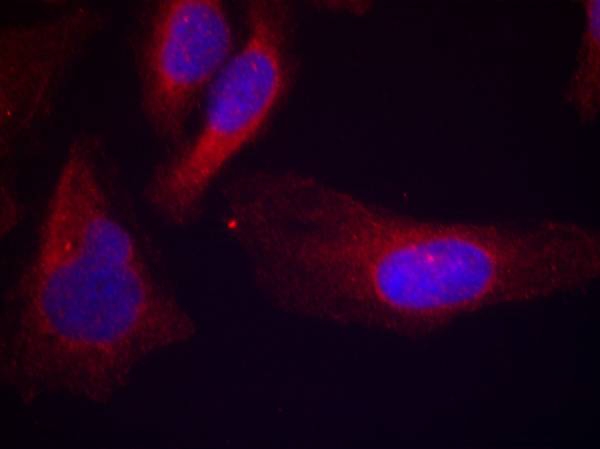 c-Cbl(phospho-Tyr700) Antibody