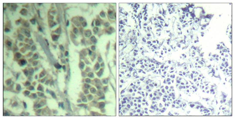 c-Cbl(phospho-Tyr700) Antibody