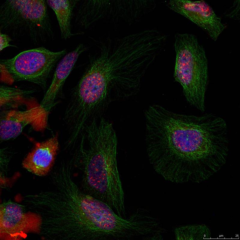 MDM2(phospho-Ser166) Antibody