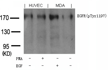 EGFR(phospho-Tyr1197) Goat Polyclonal Antibody