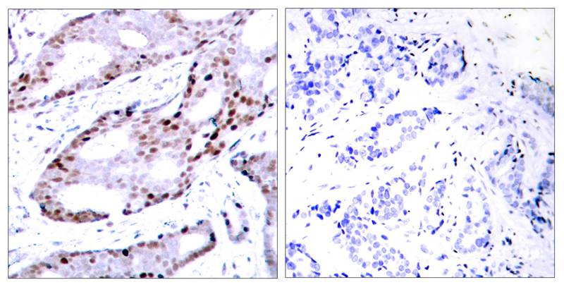 c-Jun(Ab-73) Antibody