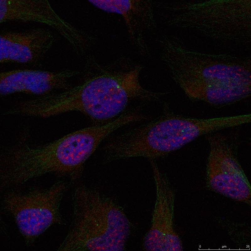 NFkB-p65(Ab-276) Antibody
