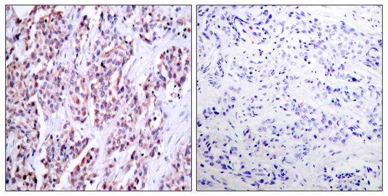 NFkB-p100(Ab-870) Antibody