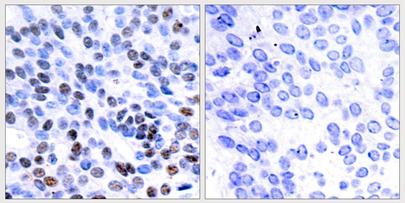 JunB(Ab-259) Antibody