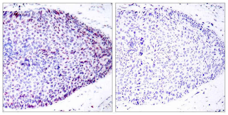 ATF2(Ab-62 or 44) Antibody