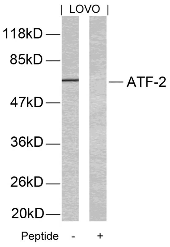 ATF2(Ab-69 or 51) Antibody
