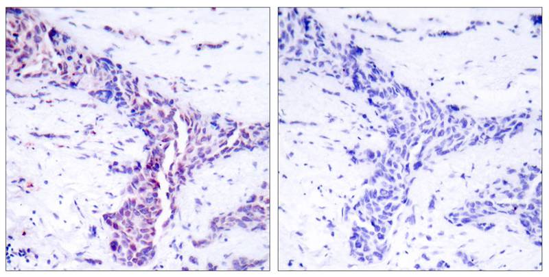 ATF2(Ab-73 or 55) Antibody
