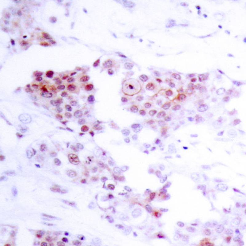 MEF2a(Ab-319) Antibody