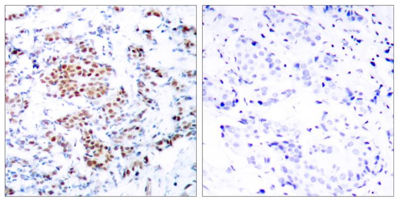 STAT5a(Ab-694) Antibody