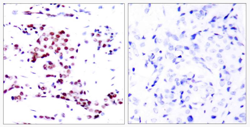 STAT5a(Ab-780) Antibody