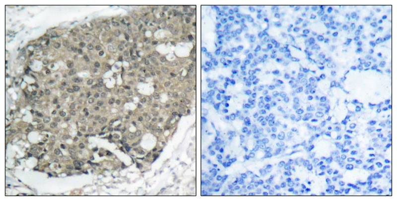 Akt(Ab-308) Antibody