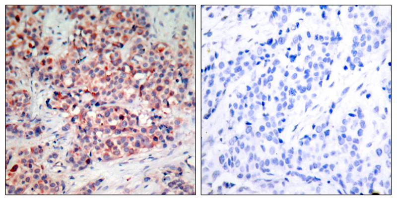 PTEN(Ab-370) Antibody