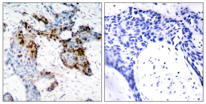 Estrogen Receptor-a(Ab-118) Antibody