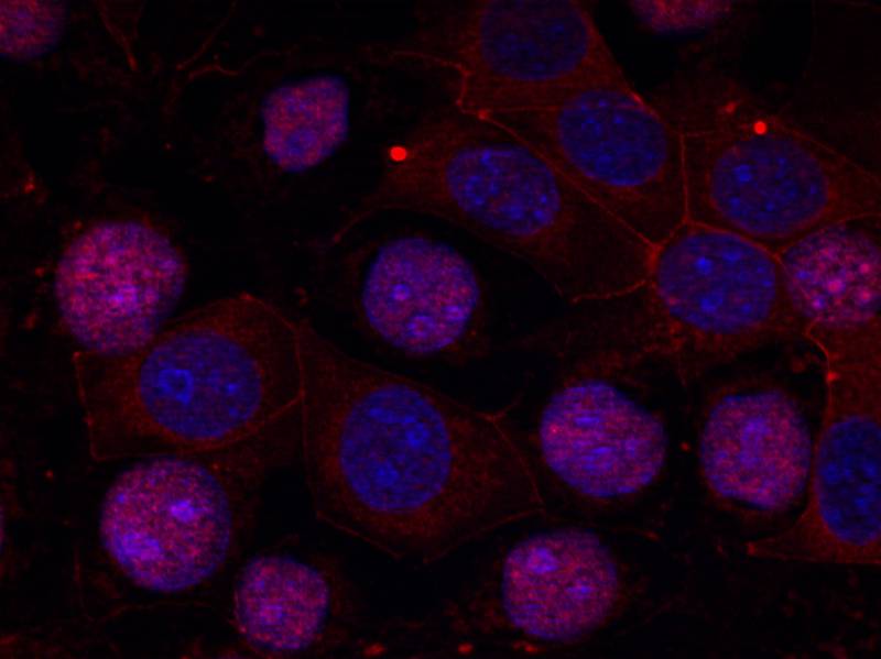 Estrogen Receptor-a(Ab-167) Antibody