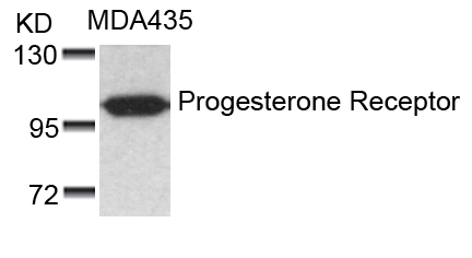 Progesterone Receptor(Ab-190) Antibody