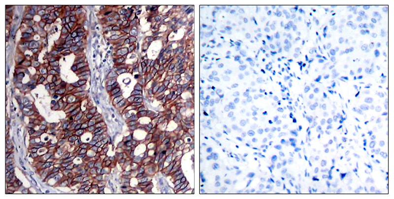 HER2(Ab-1221/1222) Antibody