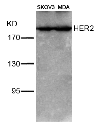 HER2(Ab-1221/1222) Antibody