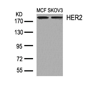 HER2(Ab-1248) Antibody