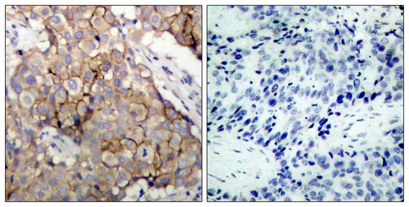 EGFR(Ab-1092) Antibody