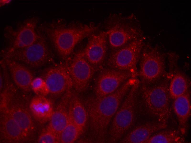 VEGFR2(Ab-1175) Antibody