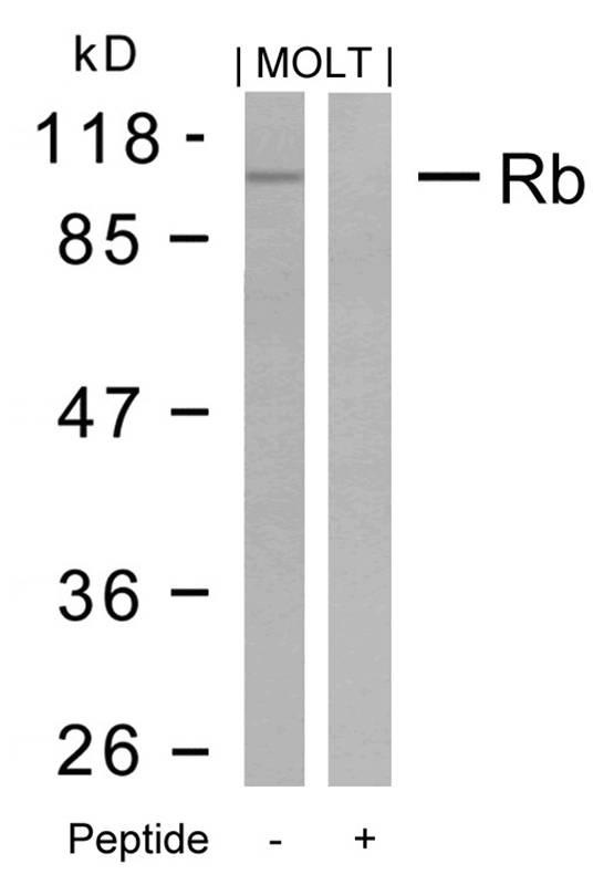 Rb(Ab-795) Antibody