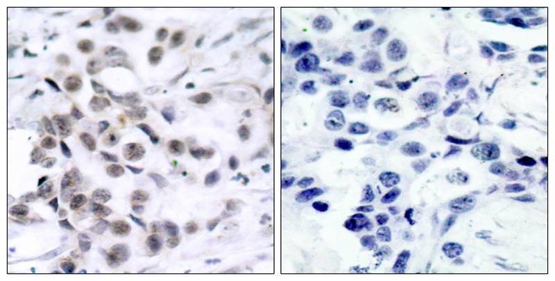 Chk1(Ab-317) Antibody