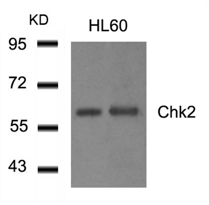 Chk2(Ab-516) Antibody