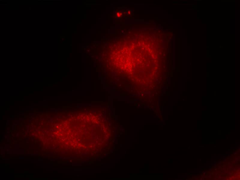 IkB-a(Ab-32/36) Antibody