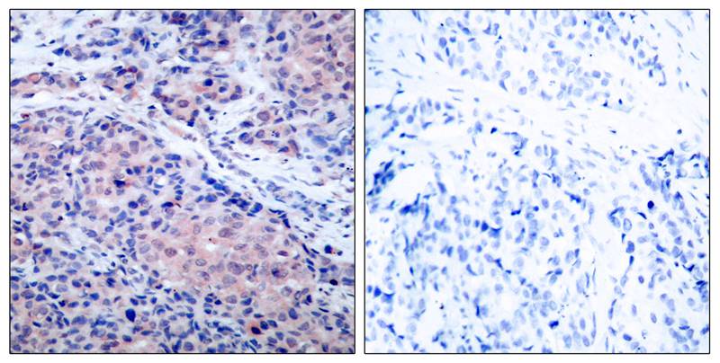 IkB-a(Ab-32/36) Antibody