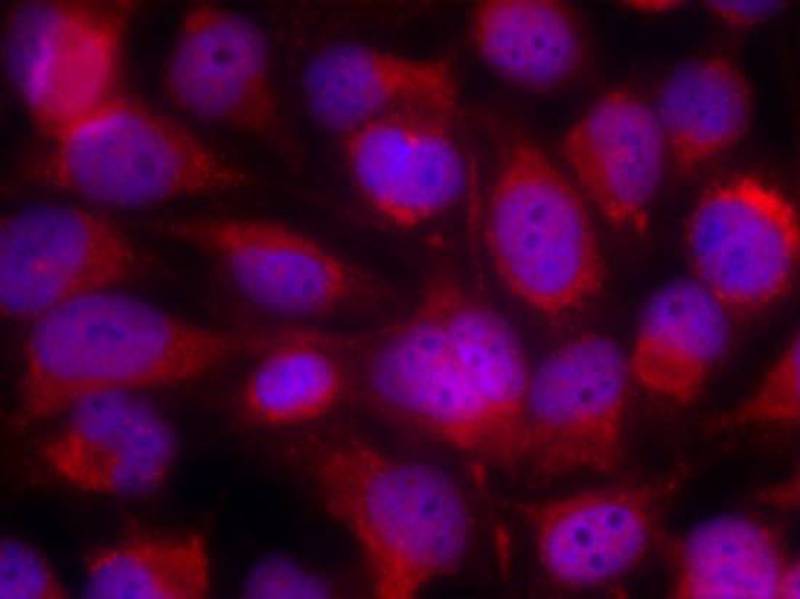 ASK1(Ab-83) Antibody