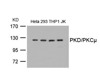 PKD/PKCm(Ab-738) Antibody