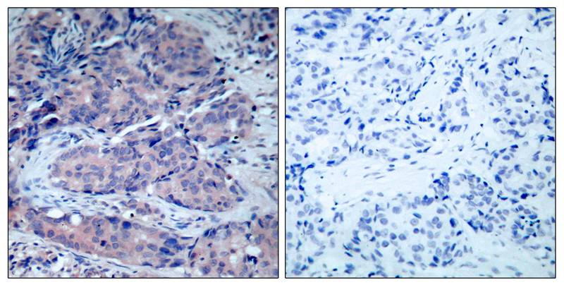 SEK1/MKK4(Ab-261) Antibody