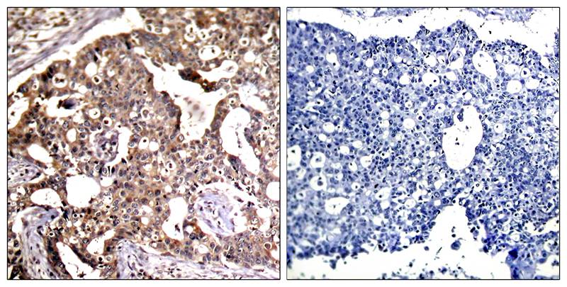 SEK1/MKK4(Ab-80) Antibody