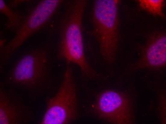 p90RSK(Ab-348) Antibody