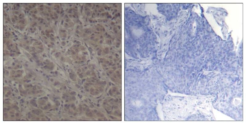 p90RSK(Ab-352) Antibody