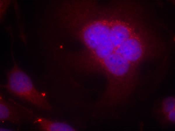 FKHR(Ab-256) Antibody