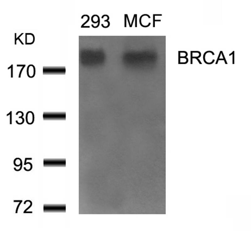 BRCA1(Ab-1524) Antibody