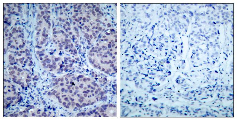 HDAC2(Ab-394) Antibody