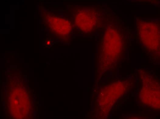cdc25C(Ab-216) Antibody