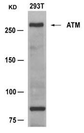 ATM(Ab-1981) Antibody