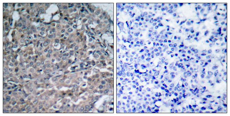 FAK(Ab-925) Antibody