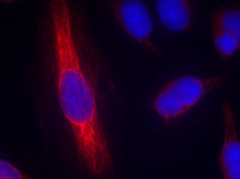 nNOS(Ab-852) Antibody - SAB | Signalway Antibody