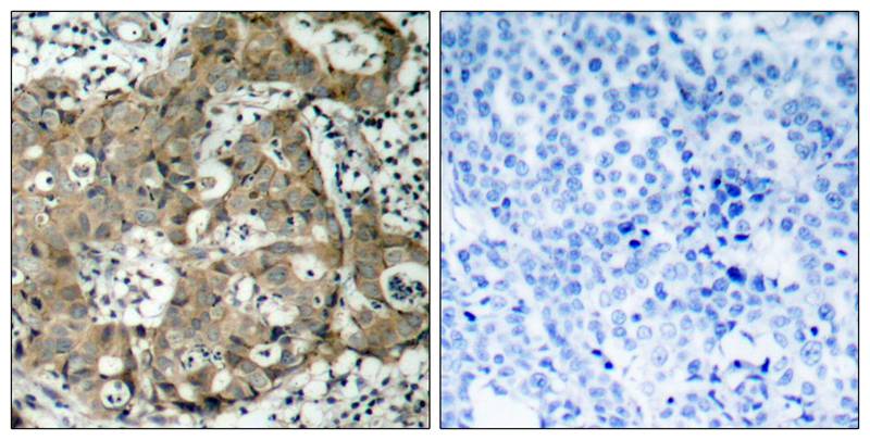 FKHR(Ab-319) Antibody