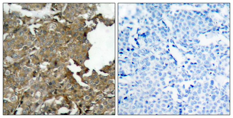 cofilin(Ab-3) Antibody