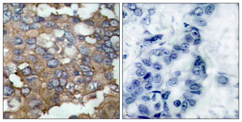 Src(Ab-529) Antibody