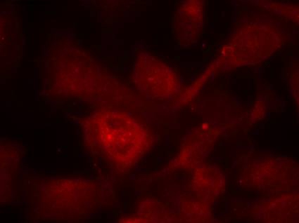 PAK1/PAK2/PAK3(Ab-423/402/421) Antibody