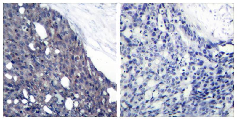IkB-a(Ab-42) Antibody