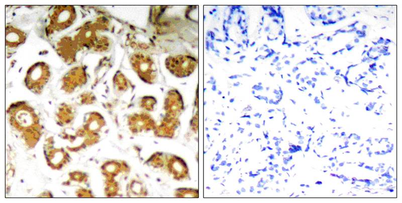 NFkB-p65(Ab-505) Antibody
